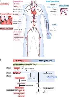 Perivascular mechanical environment: A narrative review of the role of externally applied mechanical force in the pathogenesis of atherosclerosis